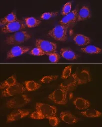 Anti-ARF1 antibody [GT1269] used in Immunocytochemistry/ Immunofluorescence (ICC/IF). GTX03181