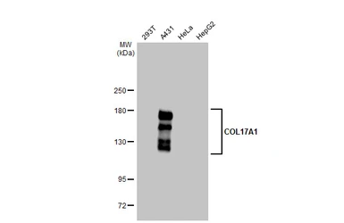 Anti-COL17A1 antibody [GT1273] used in Western Blot (WB). GTX03185