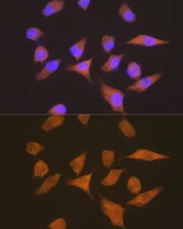 Anti-EEF1G antibody [GT1278] used in Immunocytochemistry/ Immunofluorescence (ICC/IF). GTX03190