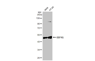 Anti-EEF1G antibody [GT1278] used in Western Blot (WB). GTX03190