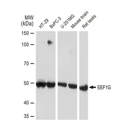 Anti-EEF1G antibody [GT1278] used in Western Blot (WB). GTX03190