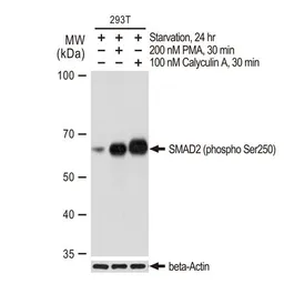 Anti-SMAD2 (phospho Ser250) antibody [GT1291] used in Western Blot (WB). GTX03203