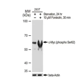 Anti-c-Myc (phospho Ser62) antibody [GT1295] used in Western Blot (WB). GTX03207