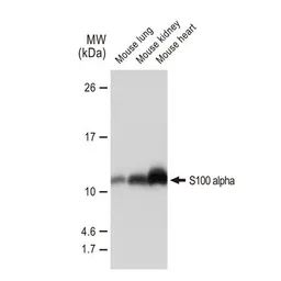 Anti-S100 alpha antibody [GT1311] used in Western Blot (WB). GTX03223