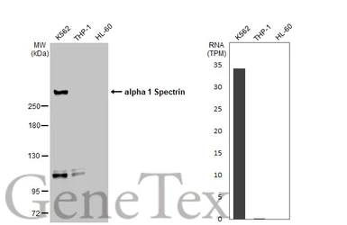 Anti-alpha 1 Spectrin antibody [GT1313] used in Western Blot (WB). GTX03225