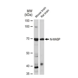 Anti-N-WASP antibody [GT1328] used in Western Blot (WB). GTX03240