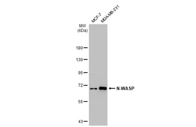 Anti-N-WASP antibody [GT1328] used in Western Blot (WB). GTX03240