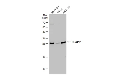 Anti-BCAP31 antibody [GT1333] used in Western Blot (WB). GTX03245