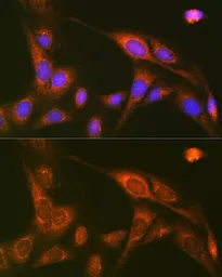 Anti-RALBP1 antibody [GT1337] used in Immunocytochemistry/ Immunofluorescence (ICC/IF). GTX03249