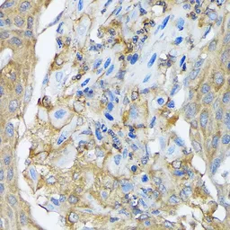 Anti-RALBP1 antibody [GT1337] used in IHC (Paraffin sections) (IHC-P). GTX03249