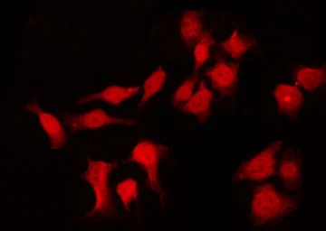 Anti-Involucrin antibody used in Immunocytochemistry/ Immunofluorescence (ICC/IF). GTX03271