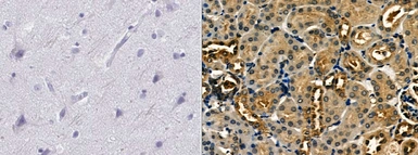 Anti-Involucrin antibody used in IHC (Paraffin sections) (IHC-P). GTX03271