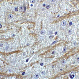 Anti-PRDM16 antibody used in IHC (Paraffin sections) (IHC-P). GTX03275