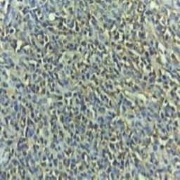 Anti-Caspase 3 (cleaved Asp175) antibody used in IHC (Paraffin sections) (IHC-P). GTX03281