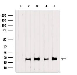 Anti-Caspase 3 (cleaved Asp175) antibody used in Western Blot (WB). GTX03281