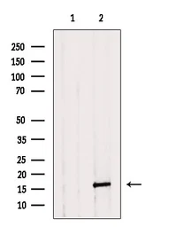 Anti-Caspase 3 (cleaved Asp175) antibody used in Western Blot (WB). GTX03281