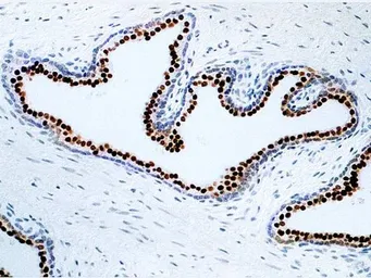 Anti-Nkx3.1 antibody [361] used in IHC (Paraffin sections) (IHC-P). GTX03296