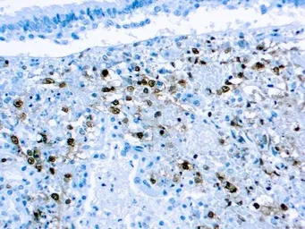 Anti-HSV2 gD antibody [DBM15.69] used in IHC (Paraffin sections) (IHC-P). GTX03305