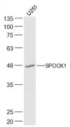 Anti-SPOCK1 antibody used in Western Blot (WB). GTX03362
