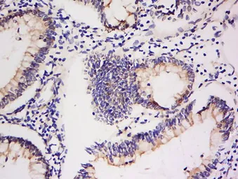 Anti-Integrin alpha V + beta 5 antibody used in IHC (Paraffin sections) (IHC-P). GTX03382