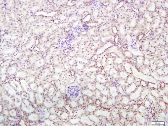 Anti-Integrin alpha V + beta 5 antibody used in IHC (Paraffin sections) (IHC-P). GTX03382