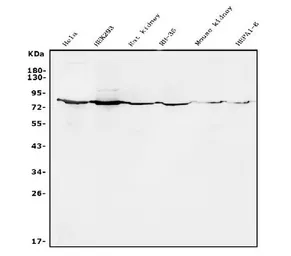 Anti-Alkaline Phosphatase (Tissue Non-Specific) antibody used in Western Blot (WB). GTX03390