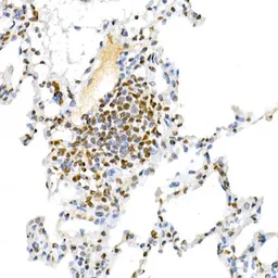 Anti-MUC2 antibody used in IHC (Paraffin sections) (IHC-P). GTX03424