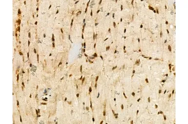 Anti-Ki67 (phospho Thr1335) antibody used in IHC (Paraffin sections) (IHC-P). GTX03435