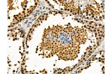 Anti-Ki67 (phospho Thr1335) antibody used in IHC (Paraffin sections) (IHC-P). GTX03435
