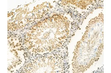 Anti-Ki67 (phospho Thr1335) antibody used in IHC (Paraffin sections) (IHC-P). GTX03435