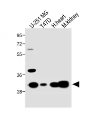 Anti-MARCH5 antibody used in Western Blot (WB). GTX03436