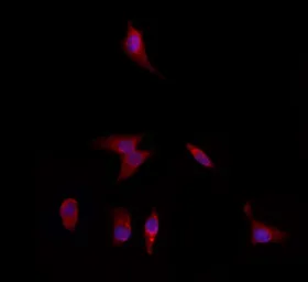 Anti-DFNA5 antibody used in Immunocytochemistry/ Immunofluorescence (ICC/IF). GTX03443