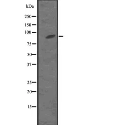 Anti-MKLP1 antibody used in Western Blot (WB). GTX03456