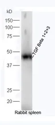 Anti-TGF beta antibody used in Western Blot (WB). GTX03464