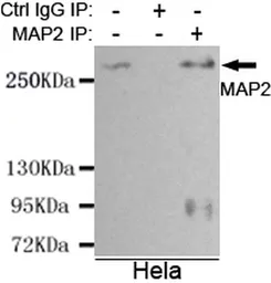 Anti-MAP2 antibody [1D7-B9-C8-F6] used in Immunoprecipitation (IP). GTX03485