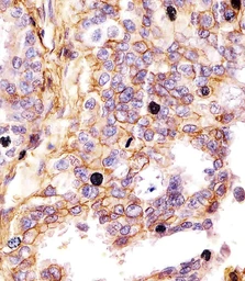 Anti-CD44 antibody [Hermes-3] used in IHC (Paraffin sections) (IHC-P). GTX03492