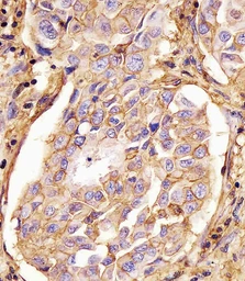 Anti-CD44 antibody [Hermes-3] used in IHC (Paraffin sections) (IHC-P). GTX03492