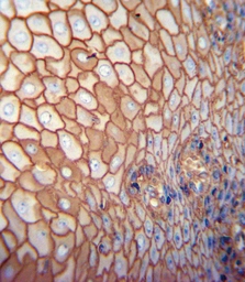 Anti-CD44 antibody [Hermes-3] used in IHC (Paraffin sections) (IHC-P). GTX03492
