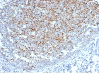 Anti-Interferon alpha 1 antibody [IFNA/6689] used in IHC (Paraffin sections) (IHC-P). GTX03591