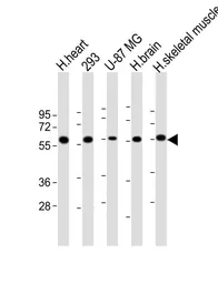 Anti-ENTPD2 antibody used in Western Blot (WB). GTX03639