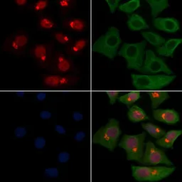 Anti-Neutrophil elastase antibody used in Immunocytochemistry/ Immunofluorescence (ICC/IF). GTX03640