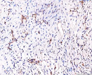 Anti-CD93 antibody used in IHC (Paraffin sections) (IHC-P). GTX03672