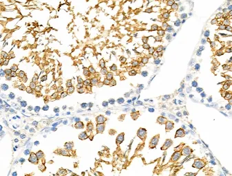 Anti-RanBP17 antibody used in IHC (Paraffin sections) (IHC-P). GTX03675
