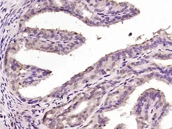 Anti-OSGIN1 antibody used in IHC (Paraffin sections) (IHC-P). GTX03681