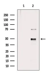 Anti-ARRDC1 antibody used in Western Blot (WB). GTX03690