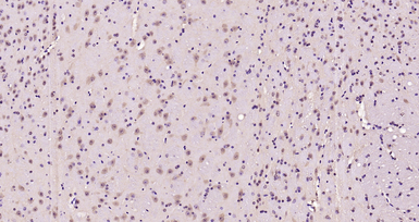 Anti-AMPK alpha 1 (phospho Thr183) + AMPK alpha 2 (phospho Thr172) antibody used in IHC (Paraffin sections) (IHC-P). GTX03702