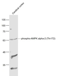 Anti-AMPK alpha 1 (phospho Thr183) + AMPK alpha 2 (phospho Thr172) antibody used in Western Blot (WB). GTX03702