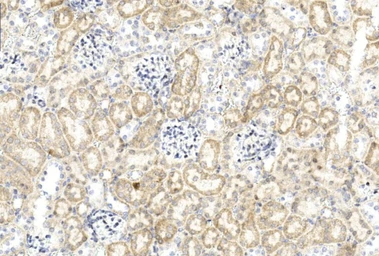 Anti-Gremlin 1 antibody used in IHC (Paraffin sections) (IHC-P). GTX03707