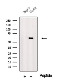 Anti-PRAME antibody used in Western Blot (WB). GTX03709