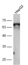 Anti-GSDMA antibody used in Western Blot (WB). GTX03715